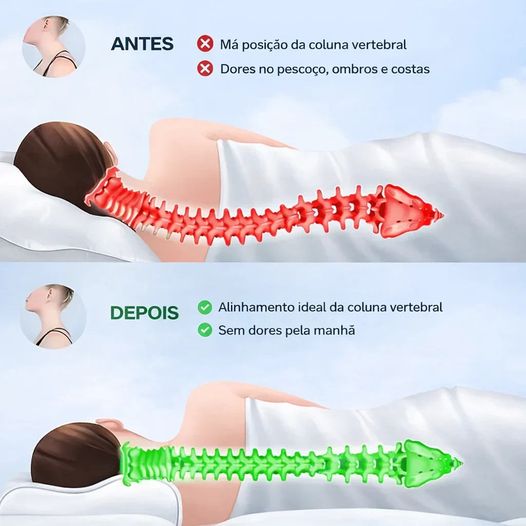 Comparativo de antes e depois de usar almofada ergonómica, mostrando alinhamento da coluna e redução de dores.